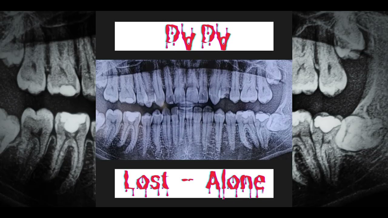 Alone - ᗪⱯᗪⱯ