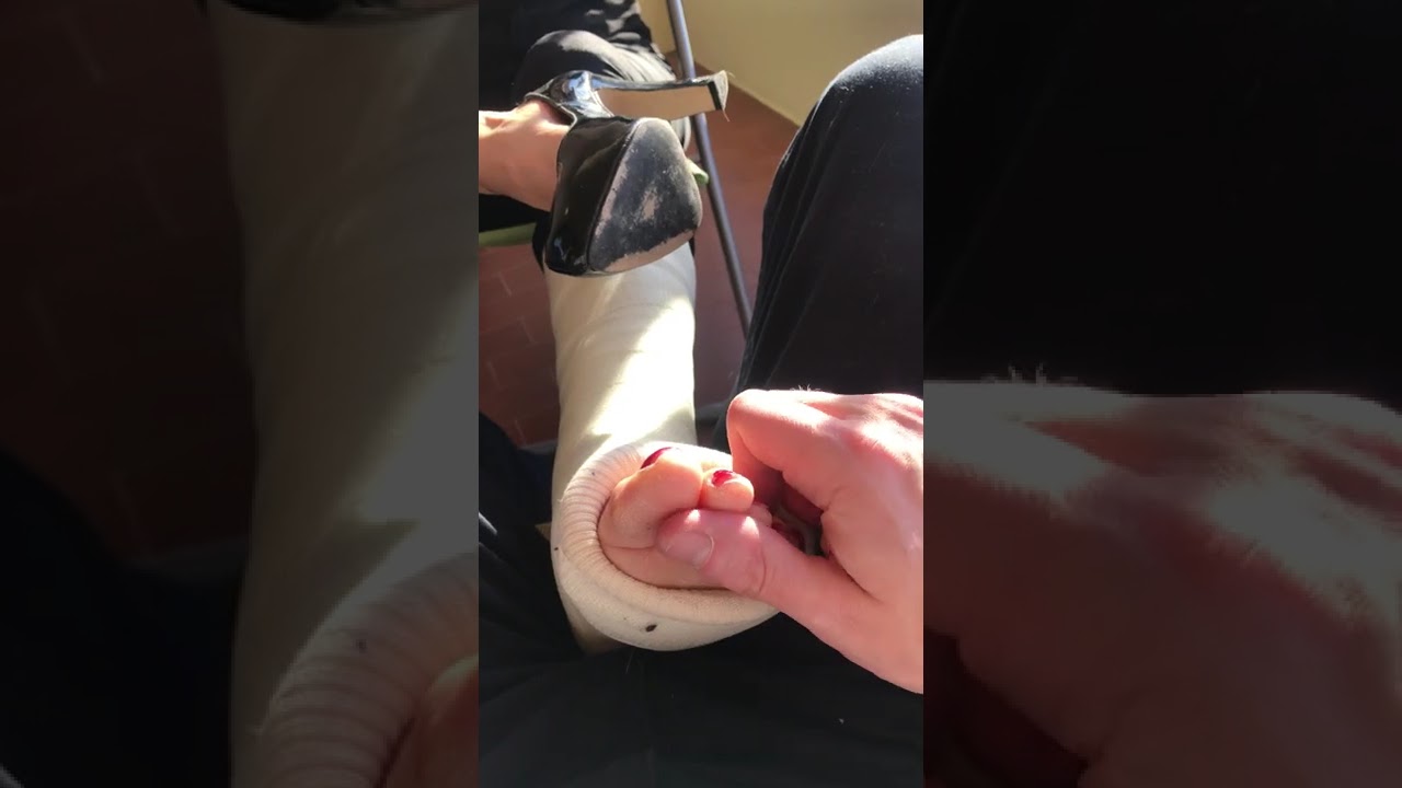 Leg Cast Girl with High Heel