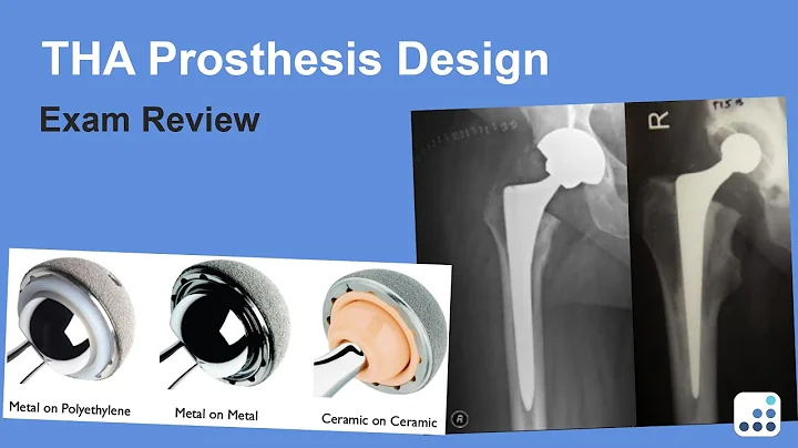 THA Prosthesis Design Exam Review - Harry Rubash, MD