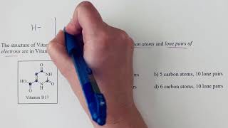 Skeletal structure interpretation example 1