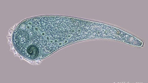 Life under microscope. #1 Stentor coeruleus.