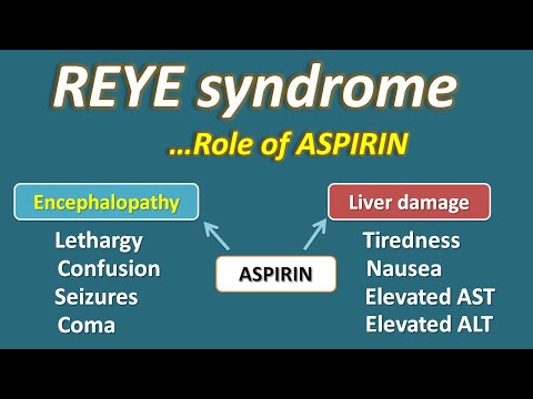 Reye syndrome and role of Aspirin