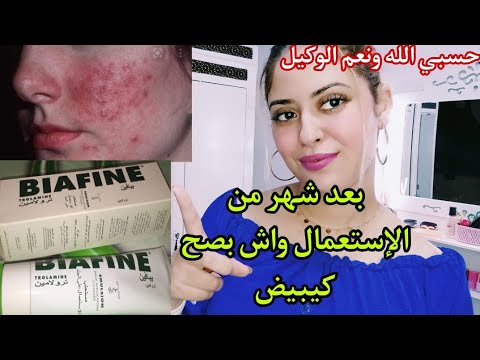 واش بصح كريم بيافين مبيض سحري للوجه والجسم والمناطق الحساسة أجيو تعرفو حقيقة هاد الكريم