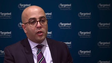 Exploring the Use of Liquid Biopsies in Smoldering Multiple Myeloma