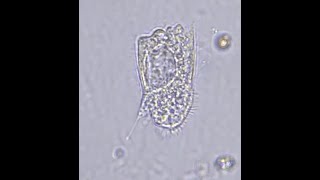 Unknown ciliate with a style