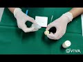 Mixing of Glass Ionomer Cement - Restorative Consistency