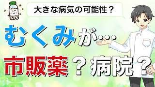 【むくみ】病院に行った方がいいのか？市販薬で対応できるのか？【薬剤師が解説】