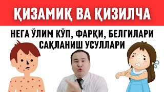 Қизамиқ Корь Хақида Бафуржа, Қизилчадан Фарқи, Белгилари, Асорати Ва Даво Чоралари Исчанов Доктор