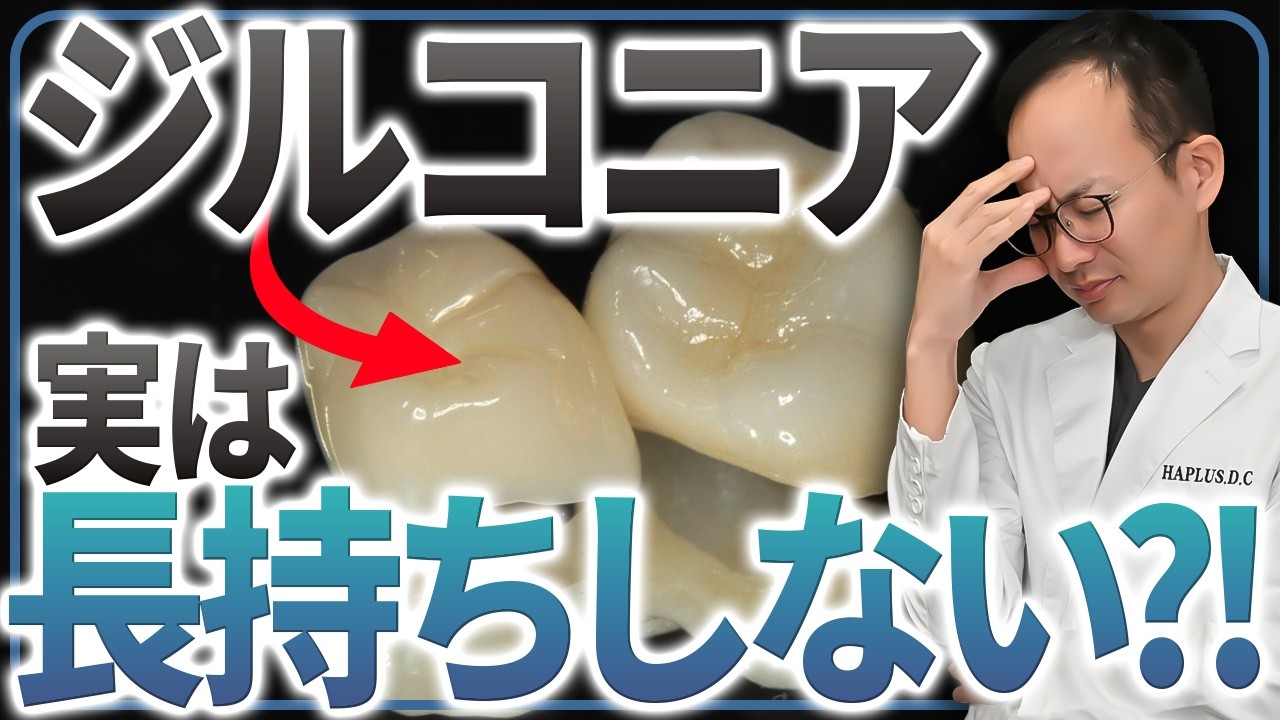 最もコスパ良く長持ちする被せ物の素材は...？現役の歯医者が被せ物の選択肢で長持ちするものをご紹介します