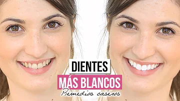 ¿Cómo consiguen las actrices tener los dientes tan blancos?