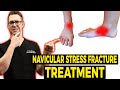 Navicular Stress Fracture: Prevalence, Symptoms, Diagnosis, and Treatment Options