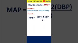 MAP | Mean Arterial Pressure | MAP Calculation