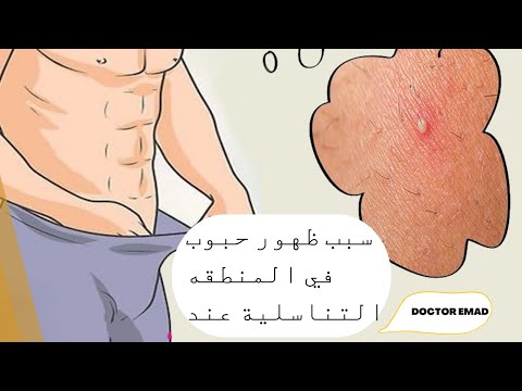 سبب ظهور حبوب في المنطقه التناسلية عند الرجال