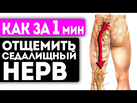 Ишиас Как Растворился! Смотрите, Как Я За 1 Мин Сделал Эти Движения И Разблокировал Седалищный Нерв