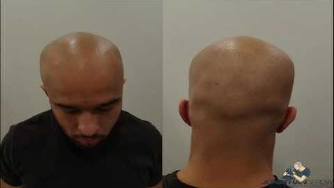 World renowned Scalp-Micropigmentation Artist Jonathan Gerow