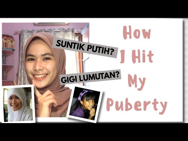 Suntik Putih? Krim Pemutih? GIGI LUMUT(AN)? | HOW I HIT MY PUBERTY class=