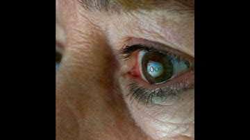 The Eye of the Patent Holder