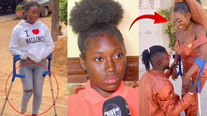 « Sama mak ladone sauvé.. » Amputée de son pied, Oumy Tiktokeuse craque en larmes et se confie «tank