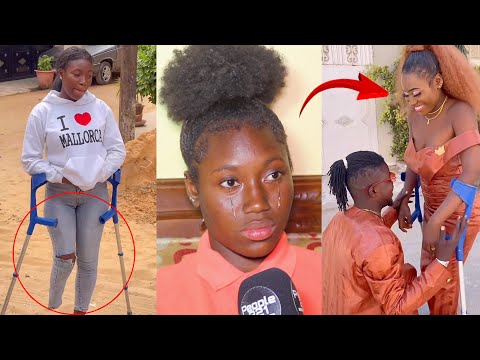« Sama mak ladone sauvé.. » Amputée de son pied, Oumy Tiktokeuse craque en larmes et se confie «tank
