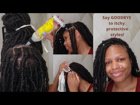 How to instantly stop itchy scalp and maintain scalp| FAUX LOCS