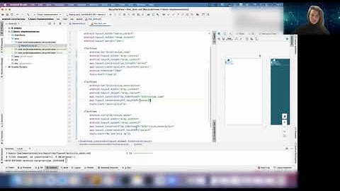 RecyclerView Complex ViewHolder
