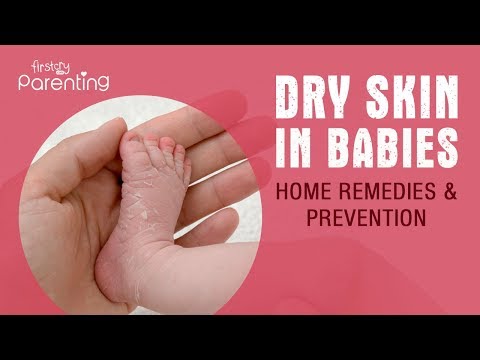 Video: Dry Skin In A Child - Causes And Methods Of Their Elimination
