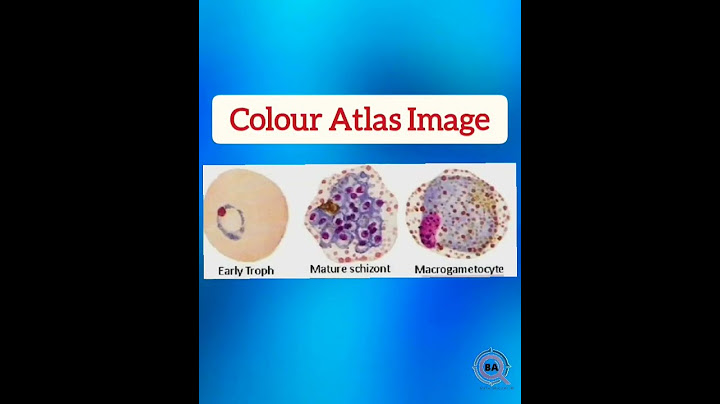 Malarial Parasite #freelecture #plasmodium #vivax  #viralvideo