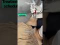 Clim Clinic, Toning