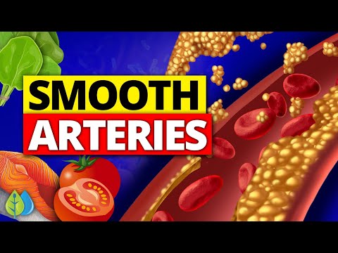 ❣️Top 10 Best Foods to Clean your Arteries and Prevent Heart Attack