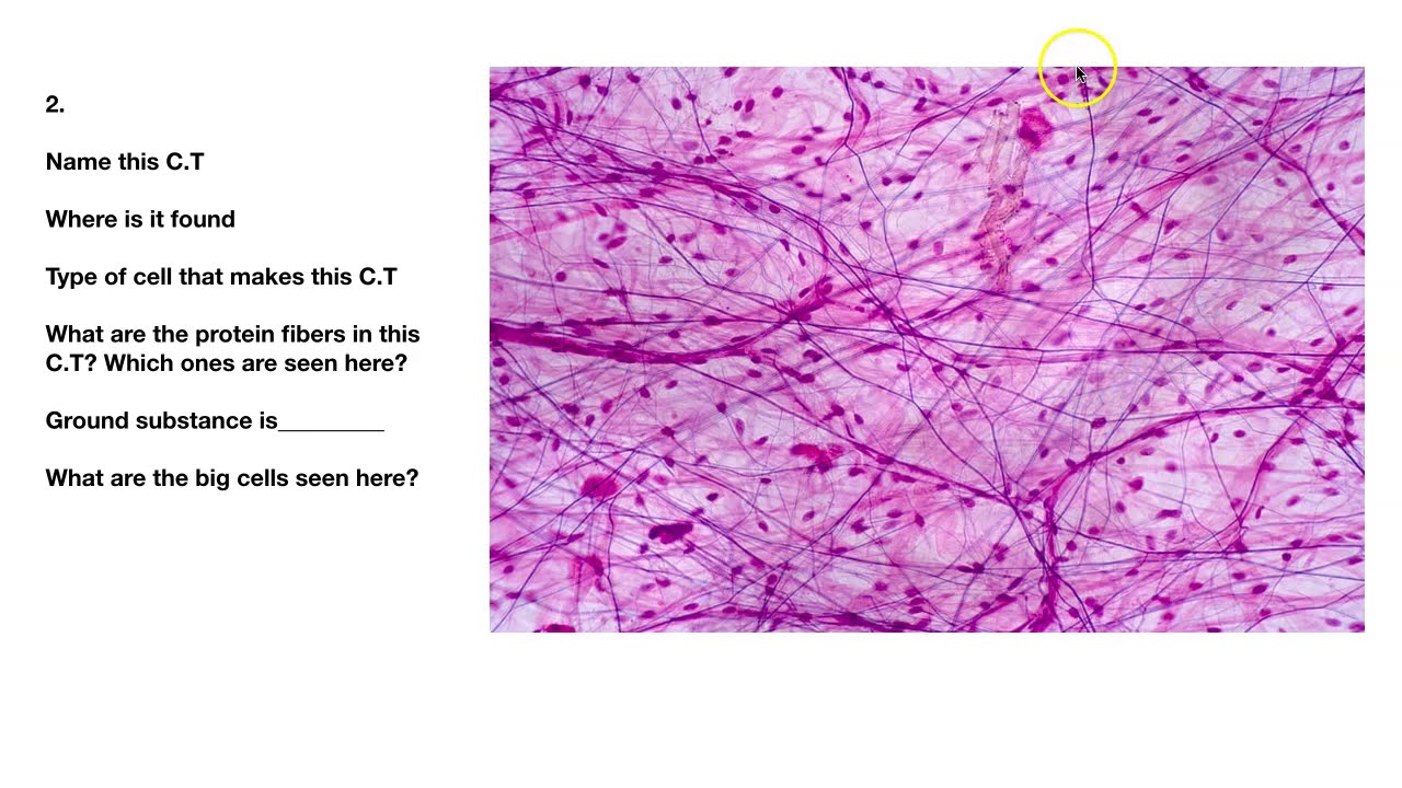 Connective Tissue Quiz and Review - YouTube