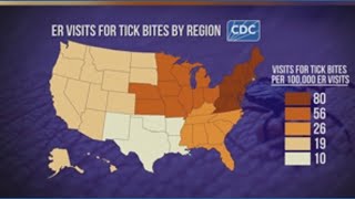 CDC warns of growing Lyme disease risk