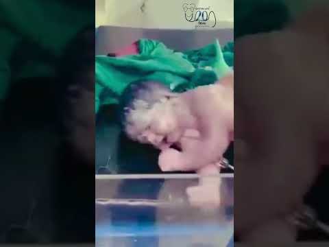 Video: Kdaj oživljati novorojenčka?