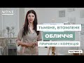 Тьмяне, в&#39;яле, втомлене, &quot;офісне&quot; обличчя - причини і корекція! Частина 2