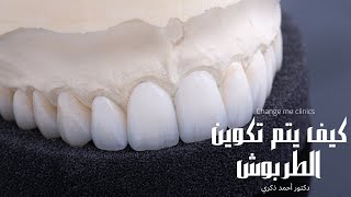 استخدام التكنولوجيا في تكوين الطربوش الأسنان بأحدث التقنيات || د. أحمد ذكري