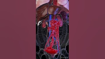 A ticking time bomb within you. Aortic Aneurysm!  #anatomy #animation