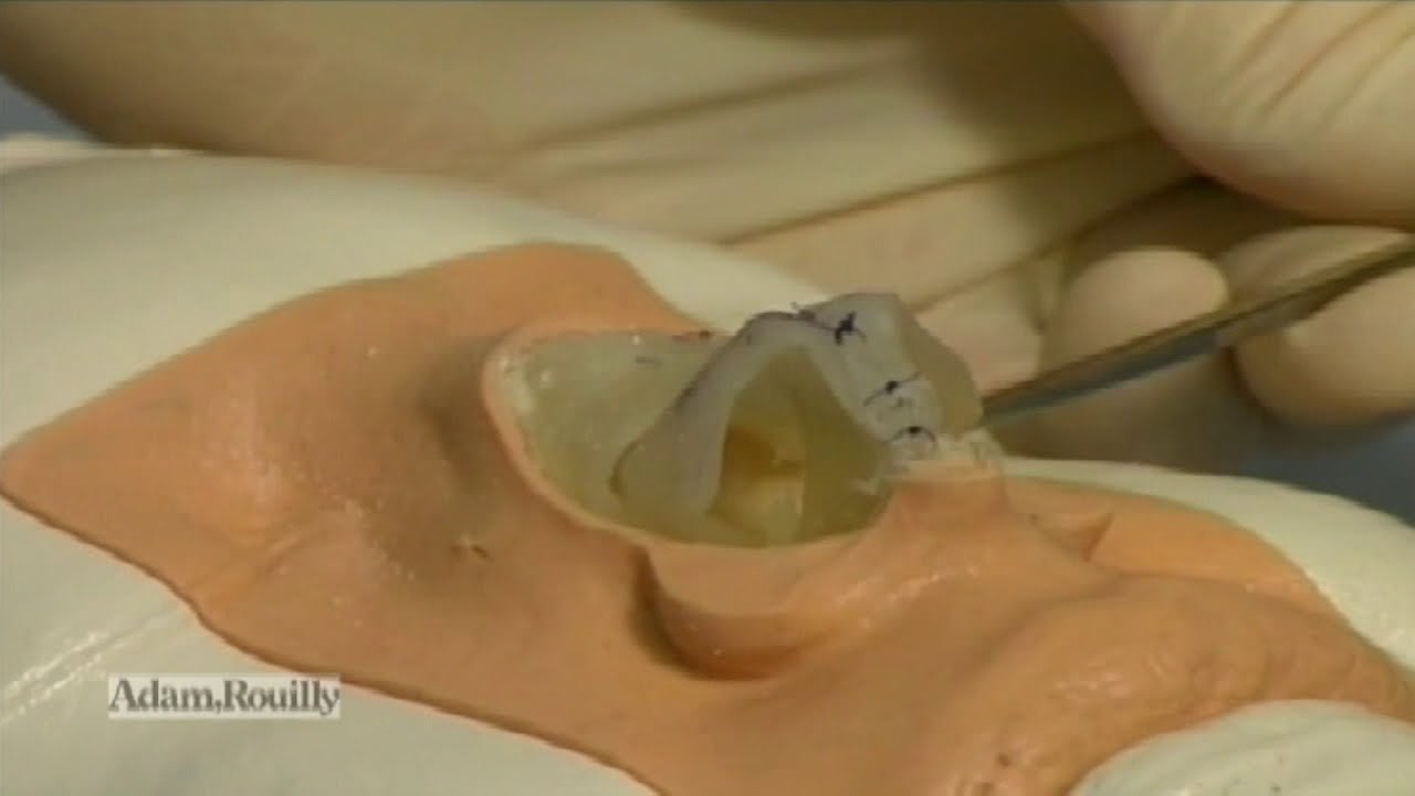 AR361 RHINOPLASTY SKILLS TRAINER