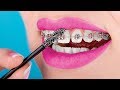 15 Crazy Braces Life Hacks You Need To Know About