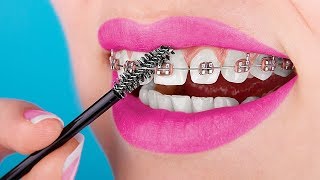 15 Crazy Braces Life Hacks You Need To Know About