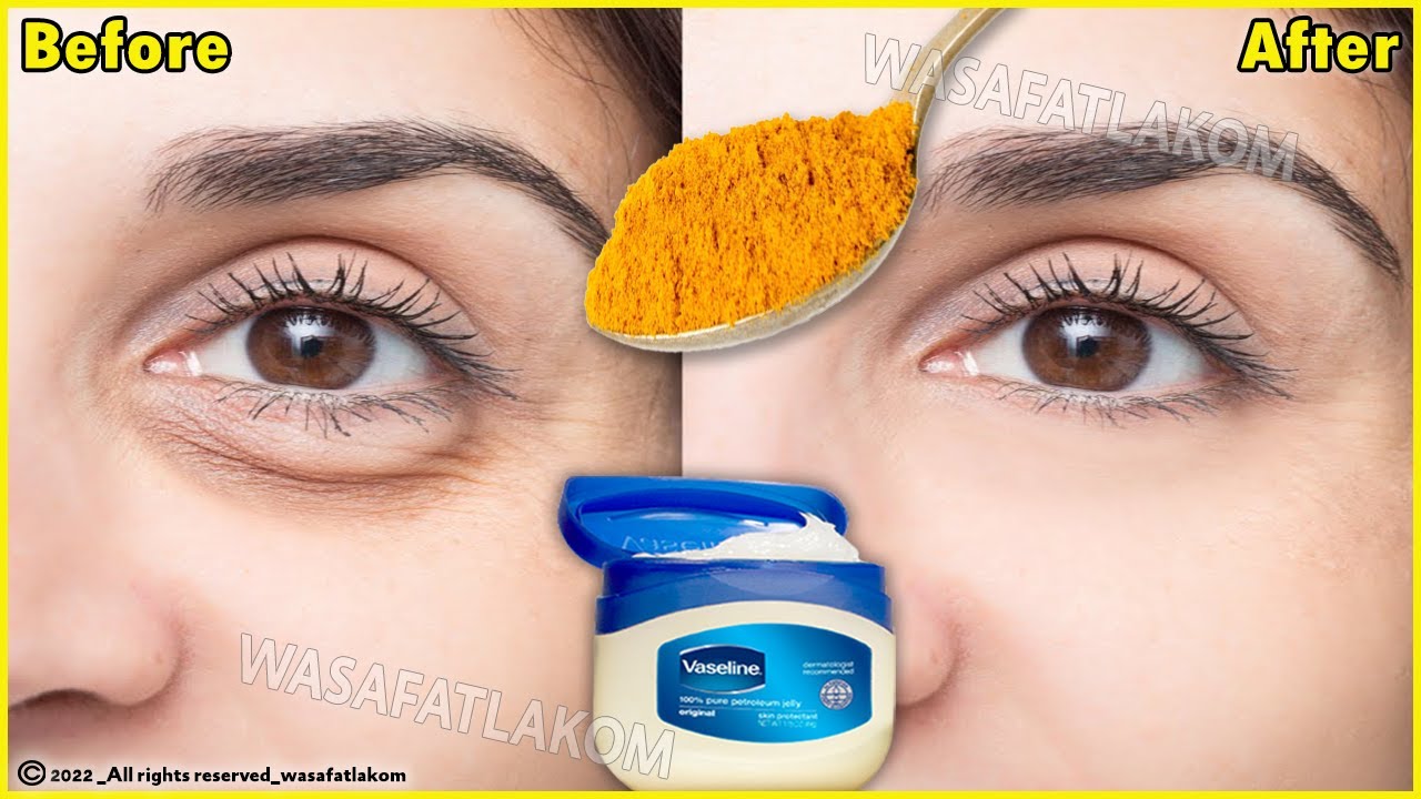 In just 3 days it removes wrinkles and bags under the eyes completely, Dark Circle, Puffy Eyes