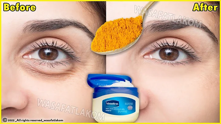 In just 3 days it removes wrinkles and bags under the eyes completely, Dark Circle, Puffy Eyes - DayDayNews