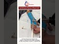 🦴 Plaster Cast कैसे remove किया जाता है? | Safe & Painless Process