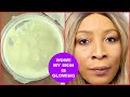 DIY POTATO CREAM, REMOVE PIGMENTATION, DARK SPOTS, ACNE SCARS ANTI - AGING, SKIN FIRMING LIGHTENING