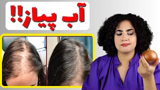 معجزه ی آب پیاز برای مو/روش تضمینی ازبین بردن بو از روی موها!