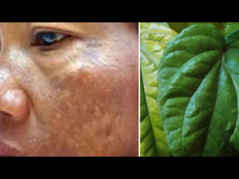 Campuran Daun Sirih Cina Untuk Menghilangkan Flek Hitam