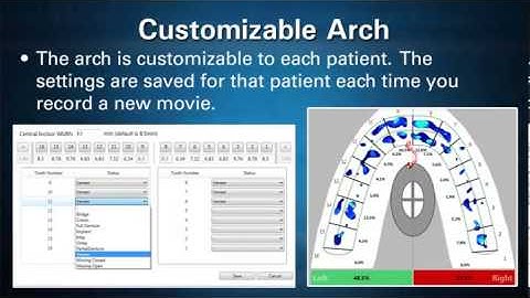 T-Scan BiteForce Dynamics
