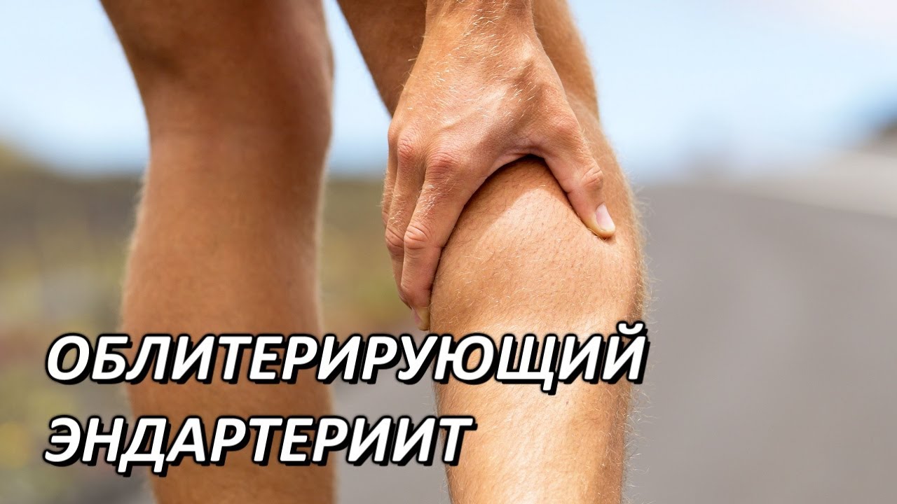 ОБЛИТЕРИРУЮЩИЙ ЭНДАРТЕРИИТ. ОБЛИТЕРИРУЮЩИЙ ЭНДАРТЕРИИТ.