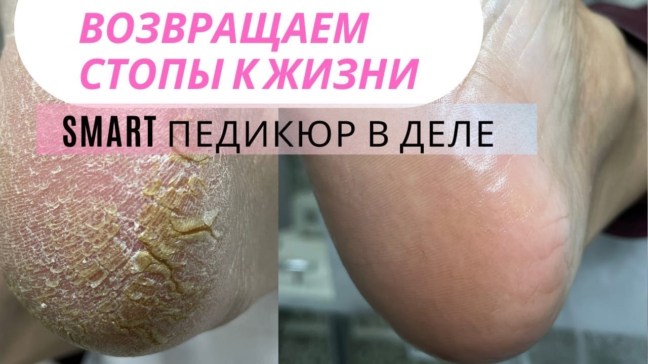 Старое обучение педикюру онлайн