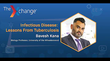 Bavesh Kana in the Xchange: Infectious Disease: Lessons From Tuberculosis