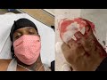 Ski Mask The Slump God Rushed To The Hospital After Cutting His Fingers Down To The Bone
