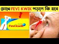 FeviKwik চোখে পড়লে কি হবে | What If FeviKwik Goes Inside The Eyes | 18 Amazing Random Facts | Facts